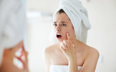 What is the Best Acne Treatment for Teens?